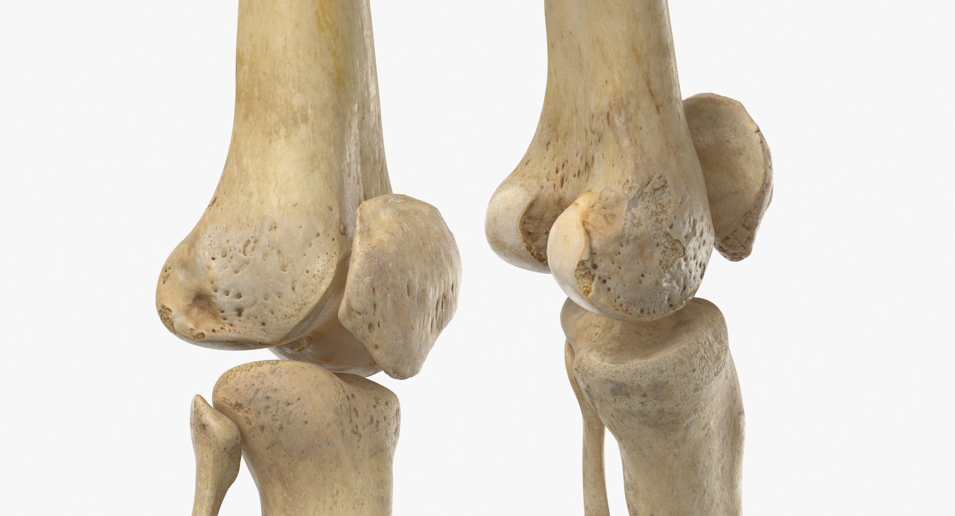 Human Female Skeleton Pose 78(1) 3D model https://p.turbosquid.com/ts-thumb/uN/D8ZlK6/6X/human_female_skeleton_pose_78_thumbnail_0017/jpg/1619787385/1920x1080/fit_q87/16814d6a1039d4c3b9a09ea71301fd92df577915/human_female_skeleton_pose_78_thumbnail_0017.jpg
