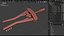ALM Retractor surgical
