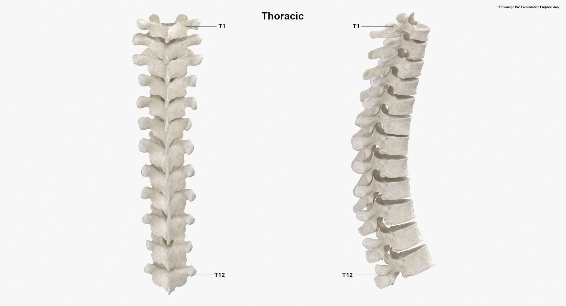 Spine 505 модель