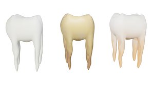3D molar teeth