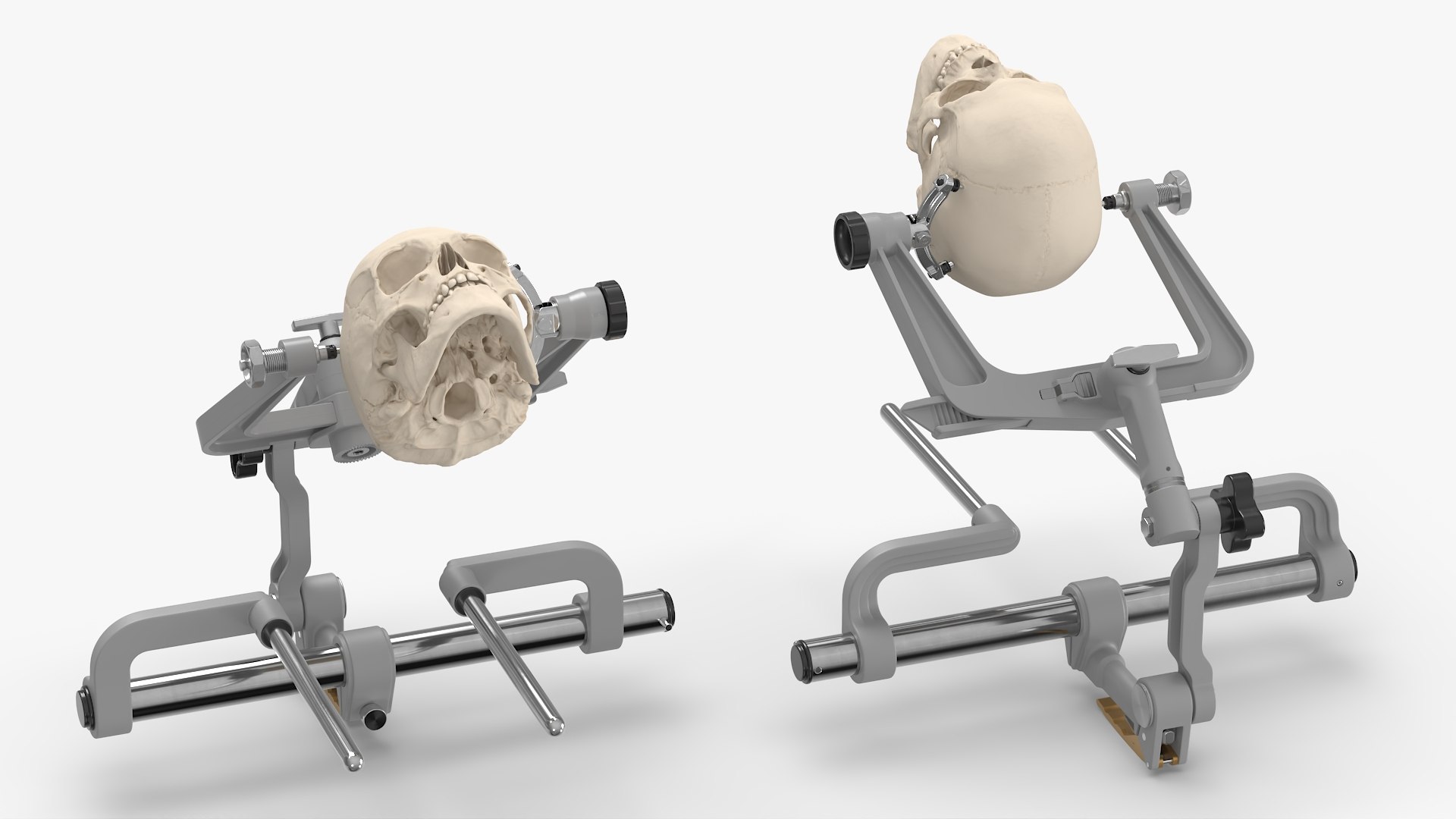 Neurosurgical Cranial Fixation Device with Skull 3D model preview