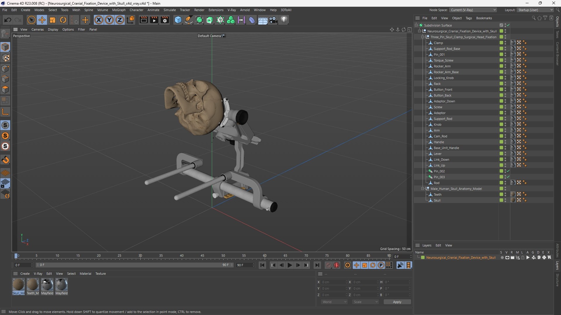 3D Neurosurgical Cranial Fixation Device with Skull model https://p.turbosquid.com/ts-thumb/un/Ns2C5U/n5/neurosurgical_cranial_fixation_device_with_skull_1003/jpg/1759471181/1920x1080/fit_q87/a05b297c9791d8596d77af8cab093ce82719143e/neurosurgical_cranial_fixation_device_with_skull_1003.jpg