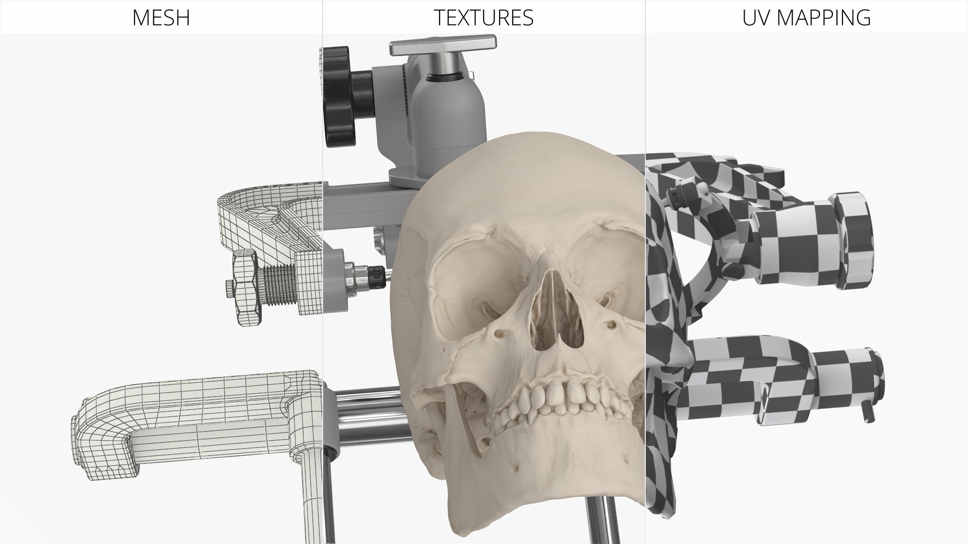 3D Neurosurgical Cranial Fixation Device with Skull model https://p.turbosquid.com/ts-thumb/un/Ns2C5U/nx/neurosurgical_cranial_fixation_device_with_skull_008/jpg/1759471174/1920x1080/fit_q87/f14f3e9e715310c1f39bc0ae24c9b66e19fc1d7c/neurosurgical_cranial_fixation_device_with_skull_008.jpg