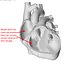 Human Heart