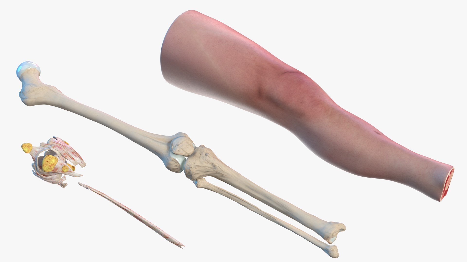 knee human anatomy rigged 3D model https://p.turbosquid.com/ts-thumb/vN/71dVNy/PA2hHO9N/kneehumananatomyriggedc4dmodel010/jpg/1593630410/1920x1080/fit_q87/d899ca43b65e53b6dc4ed5351d636343028a0b40/kneehumananatomyriggedc4dmodel010.jpg