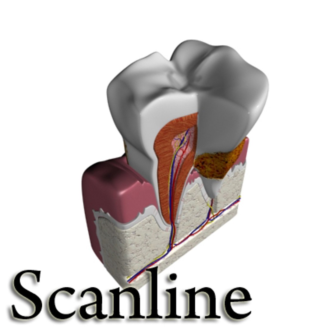 Tooth Dental Plaque 3d Model