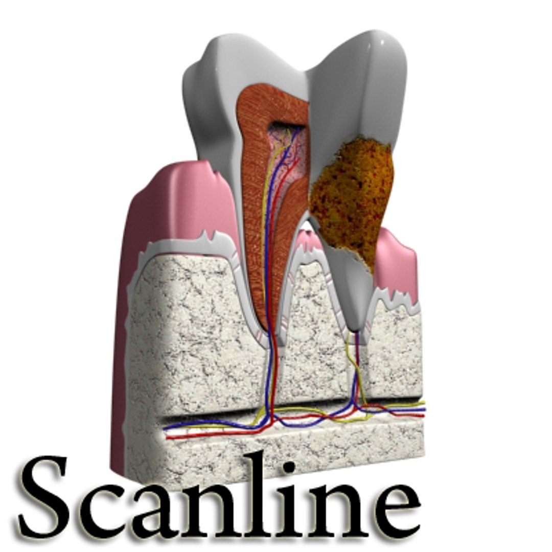 Tooth Dental Plaque 3d Model
