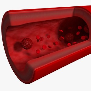 lwo cancer cell