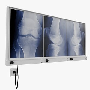 X-Ray Light Box 3D model