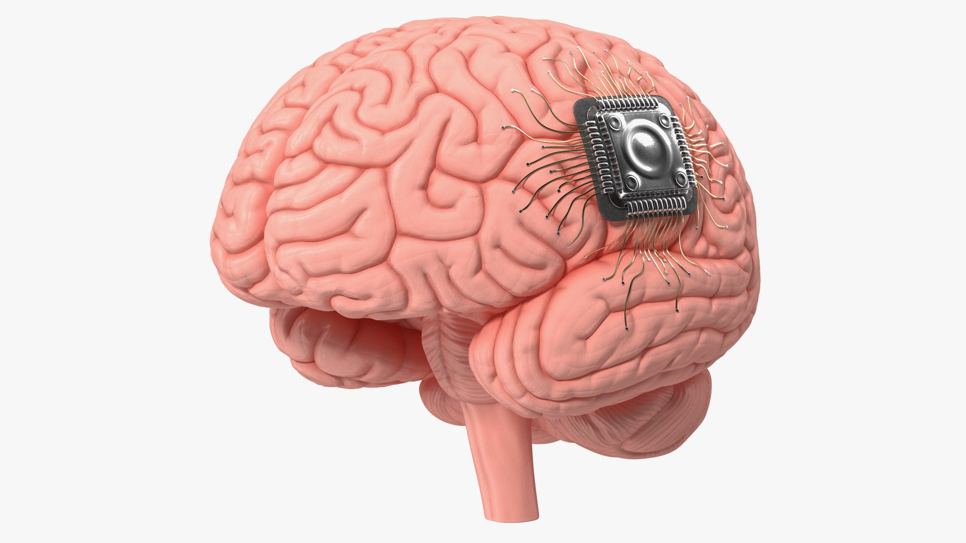 Human Brain with Implanted Microchip 3D model preview