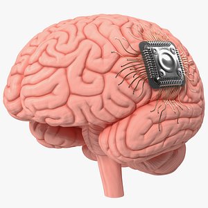 Human Brain with Implanted Microchip