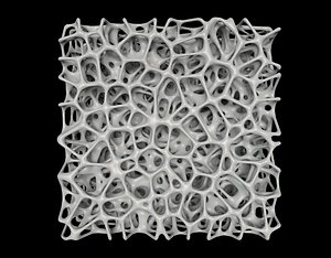 bone structure osteoporosis 3D model