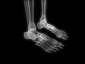 skeleton x-ray 3D model