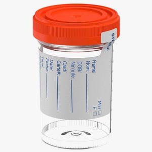 Urine Sample Empty