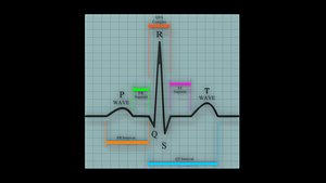 3D Ecg graph model