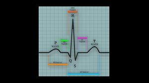 Ecg graph