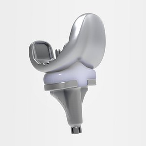 knee replacement 3D model
