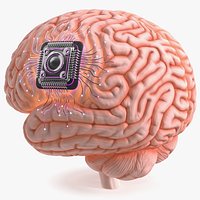 Human Brain With Implanted Microchip Lighted