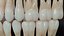 Dentes humanos sujos realistas e detalhados