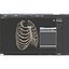 Female Ribcage Skeleton