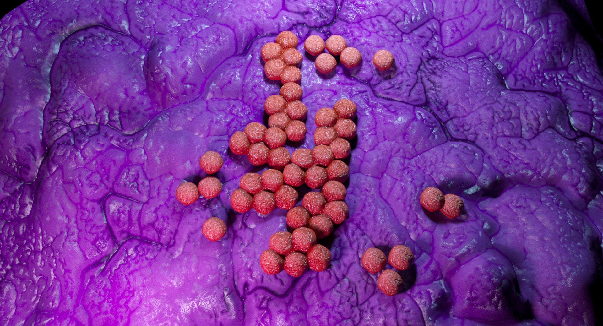 Mrsa Model - TurboSquid 1321228