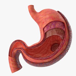 Stomach Anatomy cancer infected V02 3D model