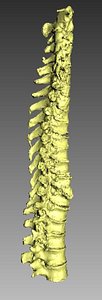 3D human spine model
