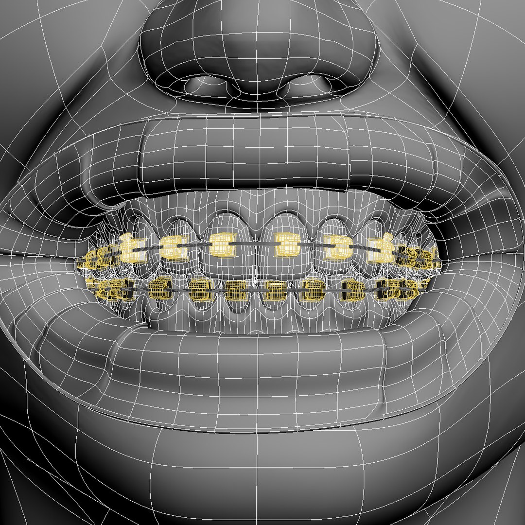 3D Model Orthodontic Head V-ray Ortho - TurboSquid 1338705