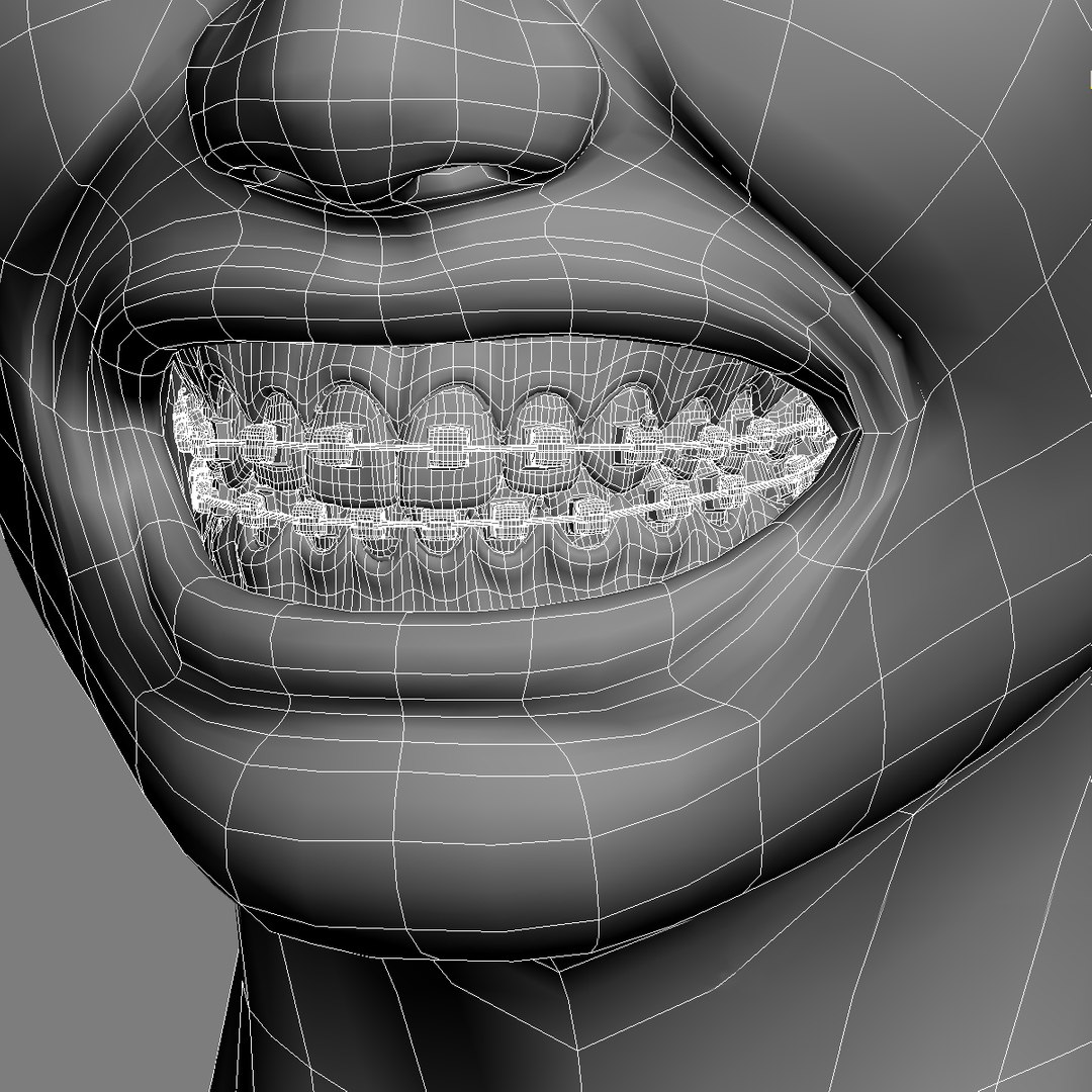 3D Model Orthodontic Head V-ray Ortho - TurboSquid 1338705