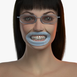 3D model orthodontic head v-ray ortho