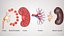 Kidney With Anatomical Cross Section