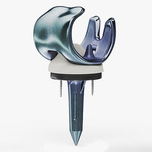 knee Implant model
