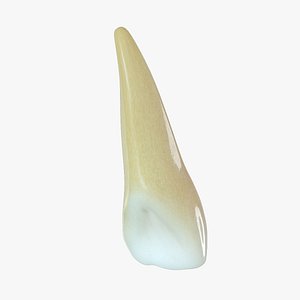 max tooth upper lateral incisor