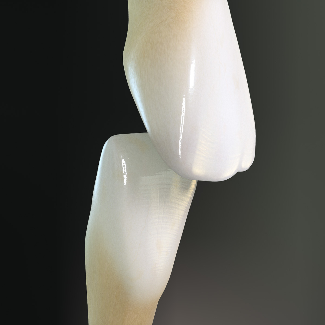 3d Model Teeth Lateral Incisors