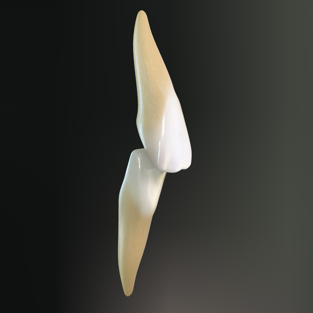 3d Model Teeth Lateral Incisors