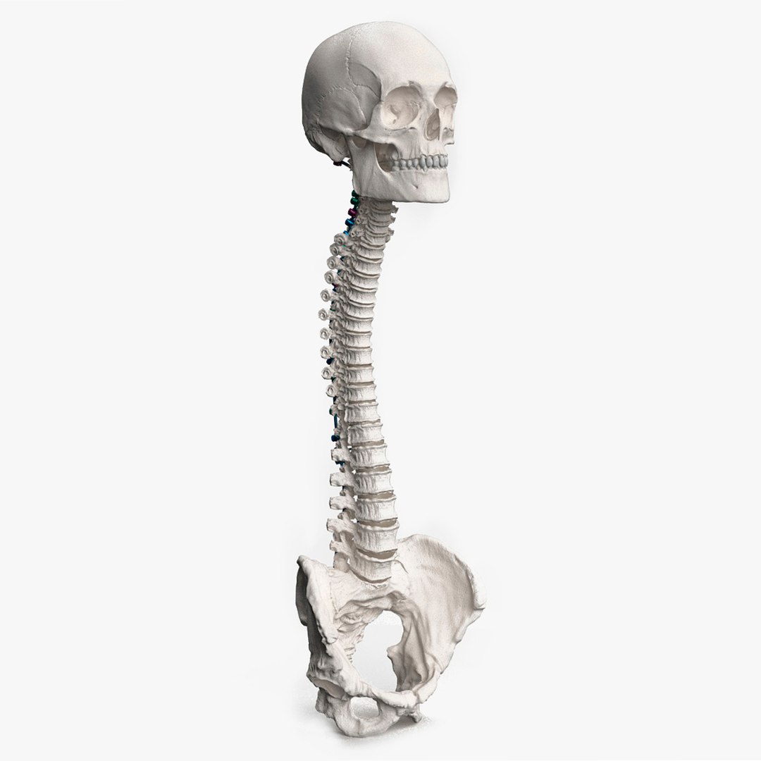 Bone Skull and Cervical Spine Fixation Colored 3D model preview