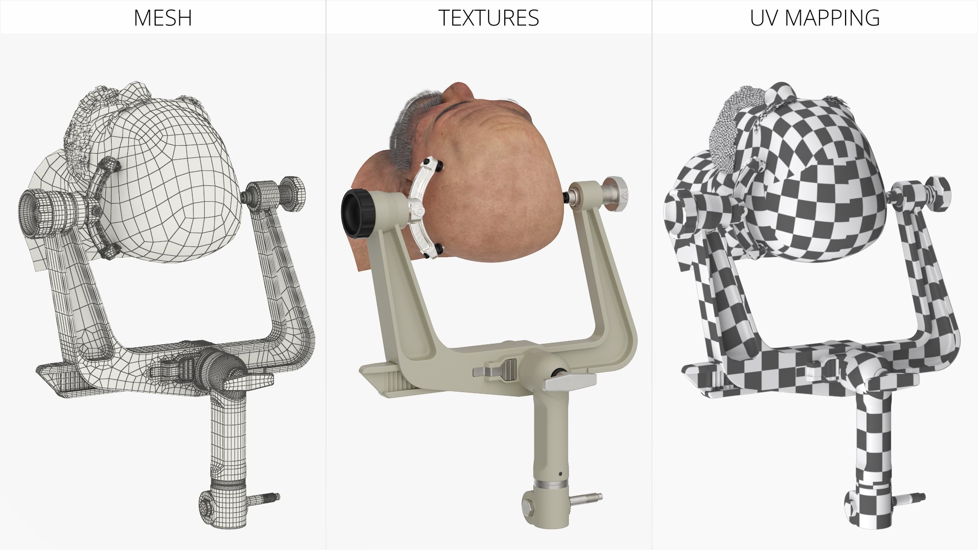 Adjustable Skull Clamp for Brain Surgery with Head 3D model https://p.turbosquid.com/ts-thumb/xU/9QBu2C/04/adjustable_skull_clamp_for_brain_surgery_with_head_008/jpg/1759423343/1920x1080/fit_q87/5ac84e09ca925af580bab27bcc70eac4be0b4aa7/adjustable_skull_clamp_for_brain_surgery_with_head_008.jpg
