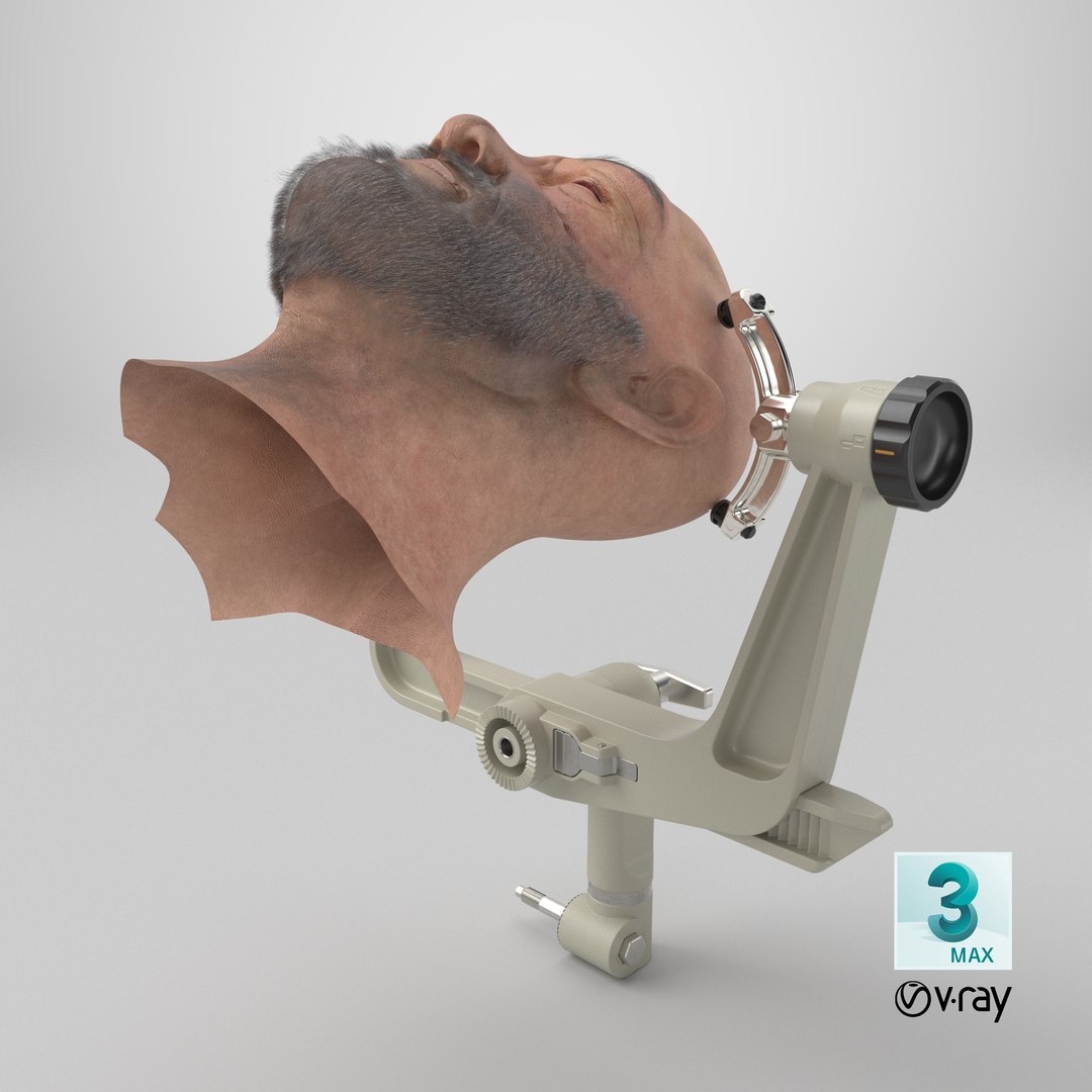 Adjustable Skull Clamp for Brain Surgery with Head 3D model https://p.turbosquid.com/ts-thumb/xU/9QBu2C/0b/stemcell_max_vray_render/png/1761052121/1920x1080/fit_q87/76cd468e95a98b8301af62b7aac5fbc965de1e15/stemcell_max_vray_render.jpg