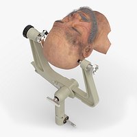 Adjustable Skull Clamp for Brain Surgery with Head