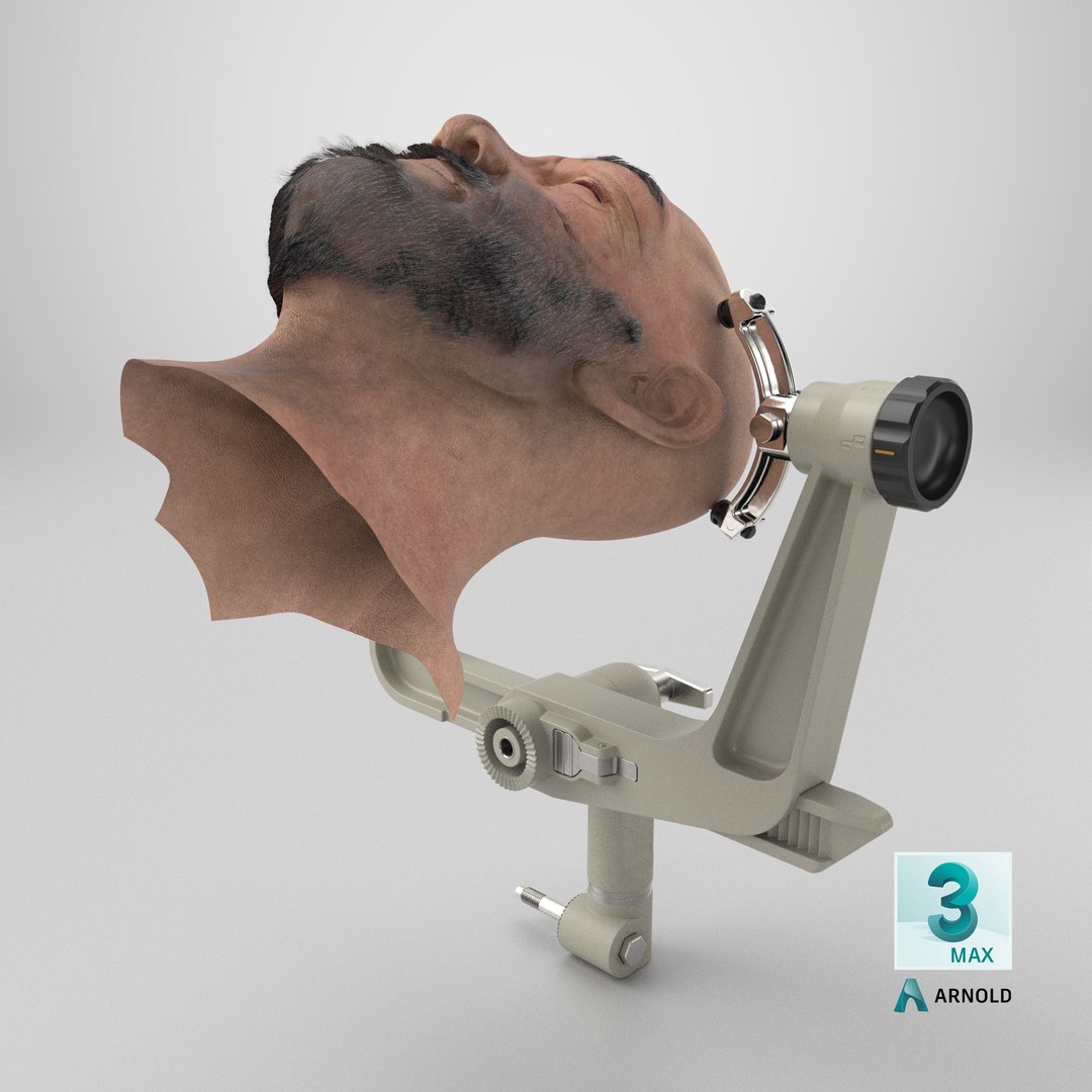 Adjustable Skull Clamp for Brain Surgery with Head 3D model https://p.turbosquid.com/ts-thumb/xU/9QBu2C/Af/stemcell_max_arnold_render/png/1761052123/1920x1080/fit_q87/2f8d3279e854ebfc3a85c1bcc6784311f455cbf3/stemcell_max_arnold_render.jpg