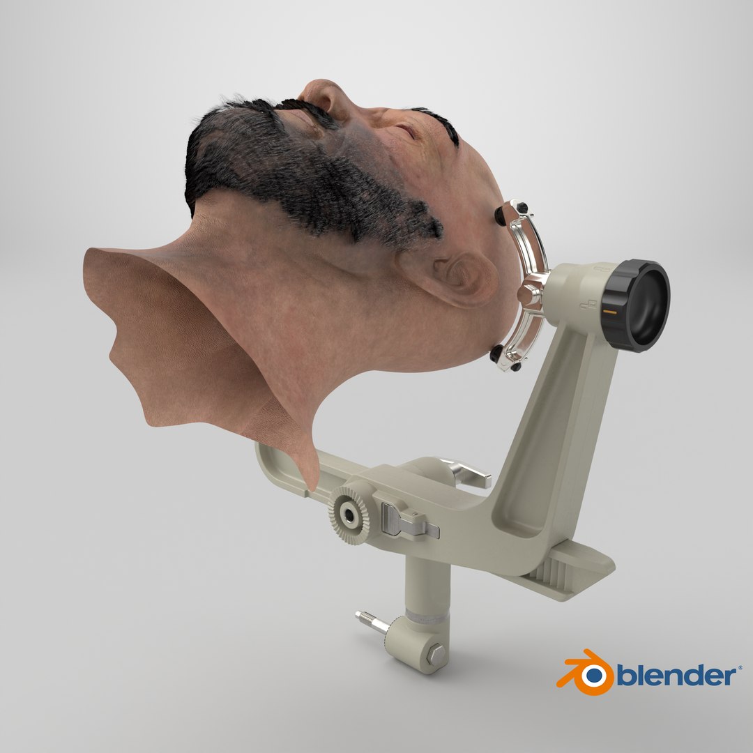 Adjustable Skull Clamp for Brain Surgery with Head 3D model https://p.turbosquid.com/ts-thumb/xU/9QBu2C/o6/stemcell_blender_cycles_render/png/1761052114/1920x1080/fit_q87/7f7ffe96cdbd7db379ec653228d9a3555f085324/stemcell_blender_cycles_render.jpg