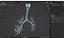 3D Bronchial Tree Anatomical Structure