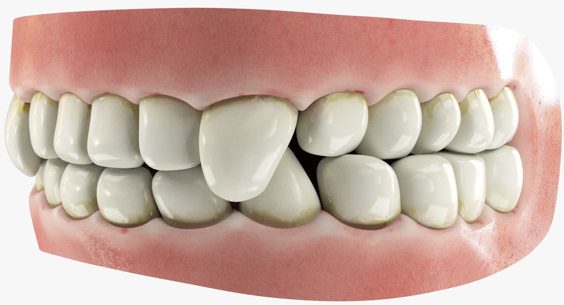 3D teeth gums tongue model https://p.turbosquid.com/ts-thumb/xq/4Pg4lD/2Mg5zKQF/001/png/1495216134/1920x1080/fit_q87/0b8e32caed33438ac6894ede702d5705e5f280f3/001.jpg