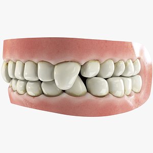 3D teeth gums tongue model