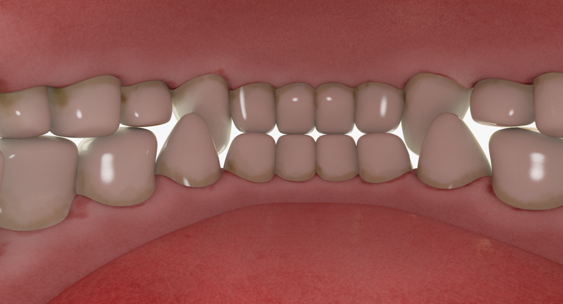 3D teeth gums tongue model https://p.turbosquid.com/ts-thumb/xq/4Pg4lD/C6C9fyAX/004_08copy/png/1495216193/1920x1080/fit_q87/5a46a80181a712029d117c34bf2ed412729dd816/004_08copy.jpg