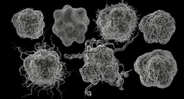 3d c4d tumor vessel