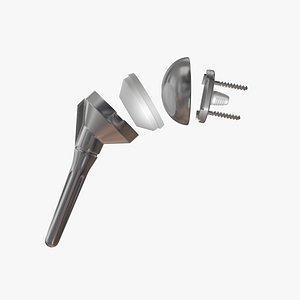 Inverse prosthesis