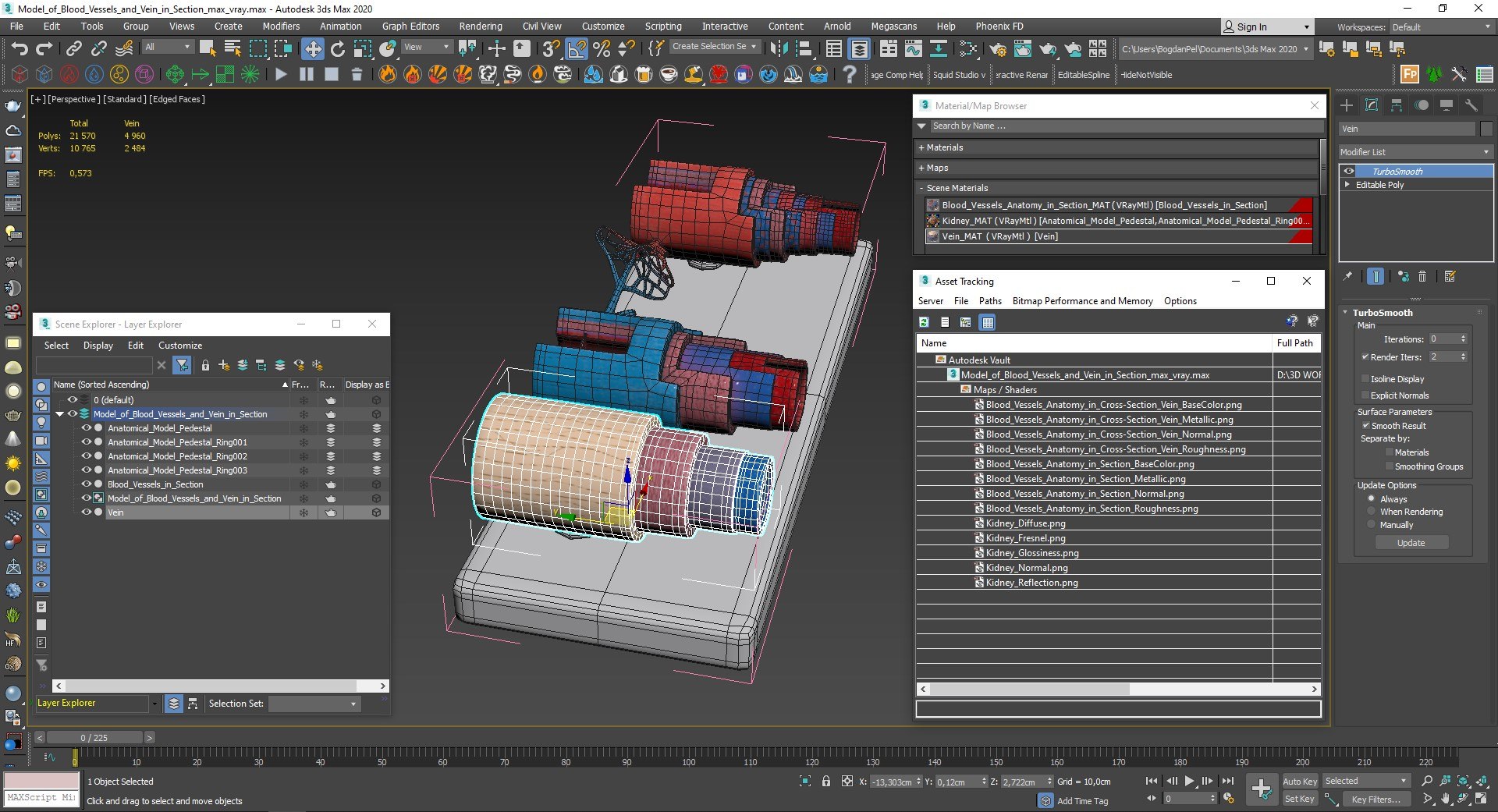 Model of Blood Vessels and Vein in Section 3D model https://p.turbosquid.com/ts-thumb/y8/GnBwaL/Gu/model_of_blood_vessels_and_vein_in_section_014/jpg/1744293290/1920x1080/fit_q87/c9665a3ab12a2b6913e670d1fad4acac8538d078/model_of_blood_vessels_and_vein_in_section_014.jpg