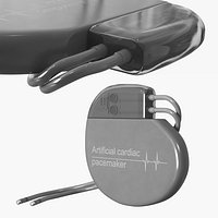 Implantable Cardiac Pacemaker with Leads Silver