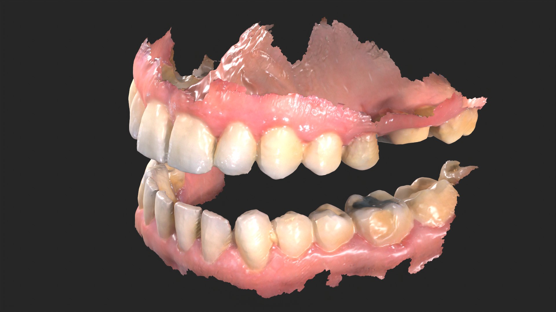 3D Dental Anatomy 3 Real Medical Cases Upper And Lower Jaw 3D Print ...